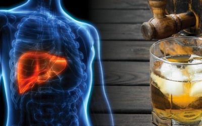 Alcoholic Liver Disease